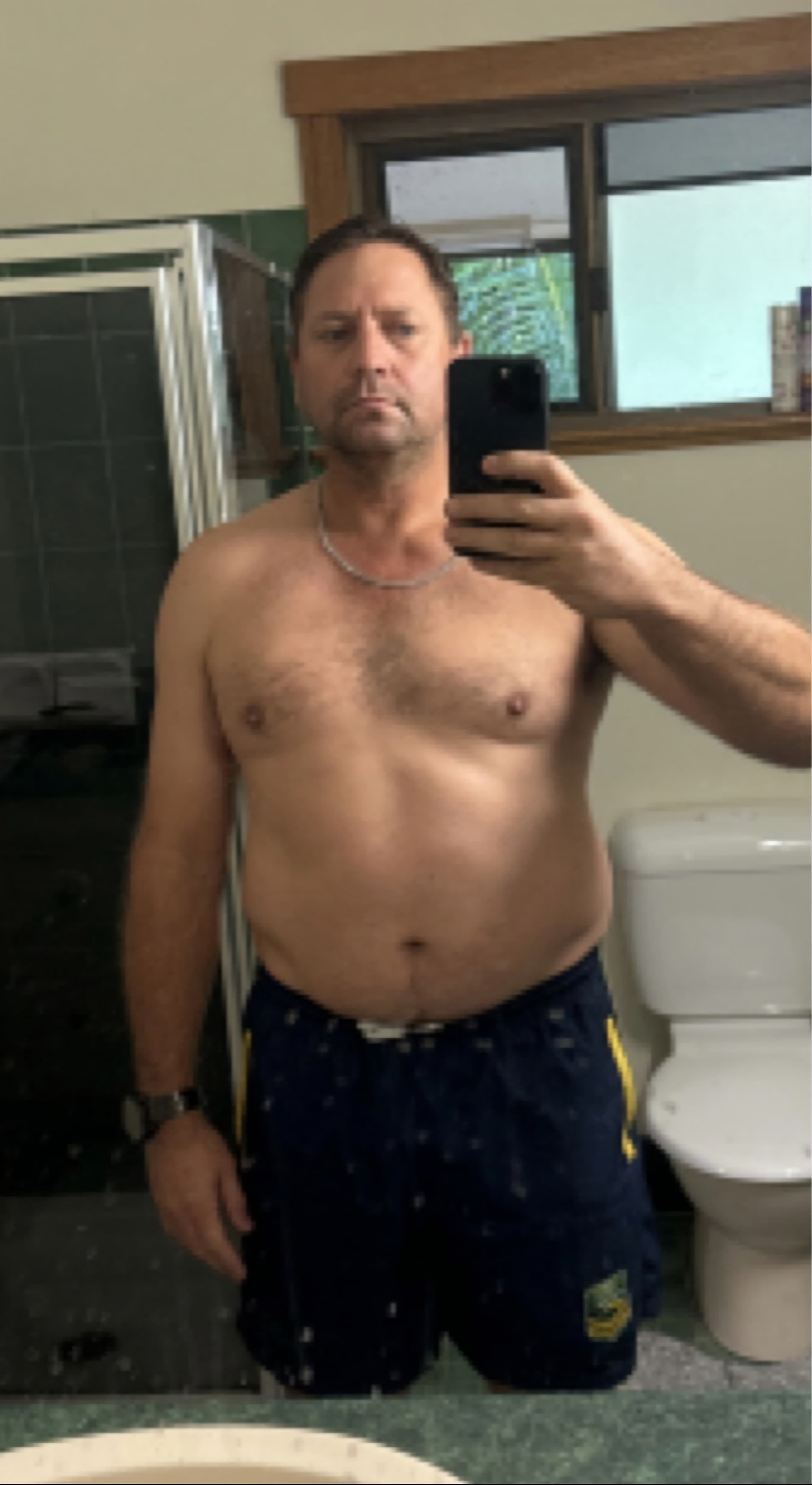 Tony  before